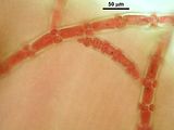 3 – Aspetto delle cellule assiali e delle zone nodali